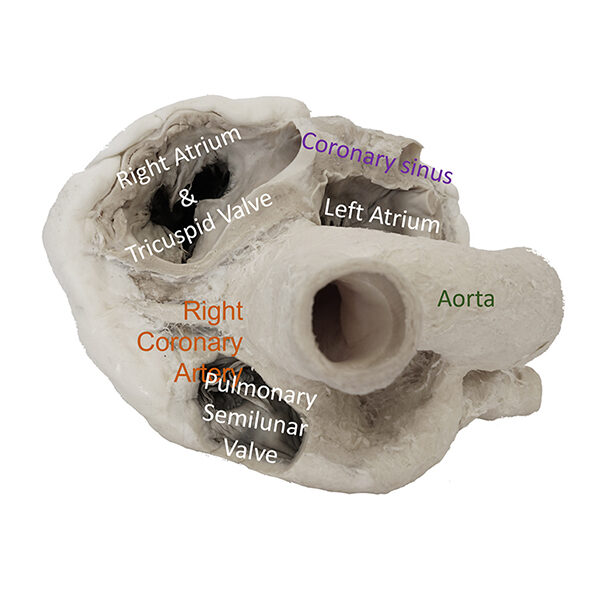 CV_Lg_4valve5