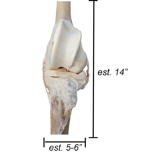 MSK_Lg_Knee1_web